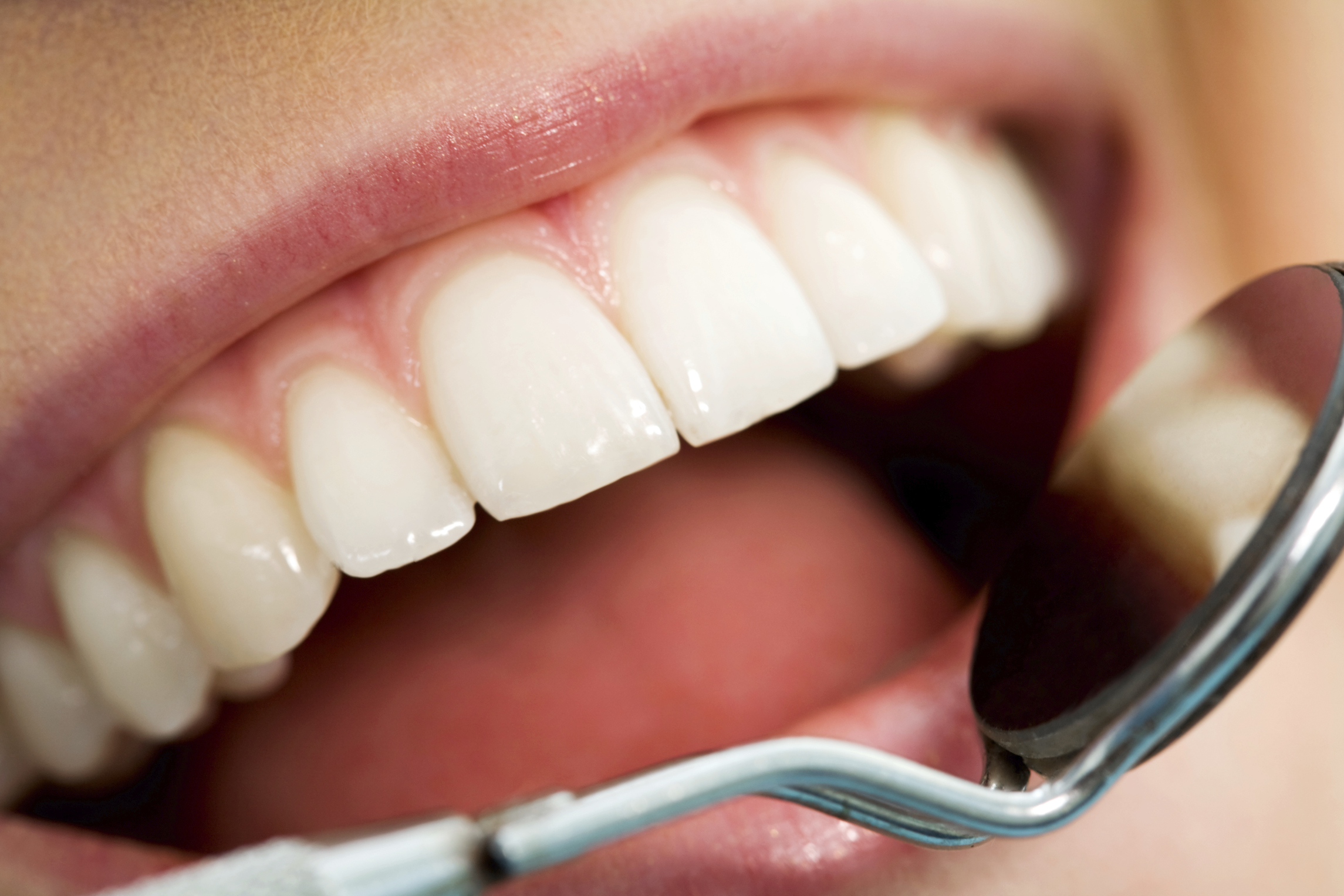 Where to Find Cosmetic Dentist